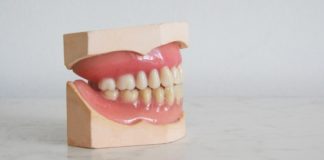 tandblekning hemma eller hos tandläkare