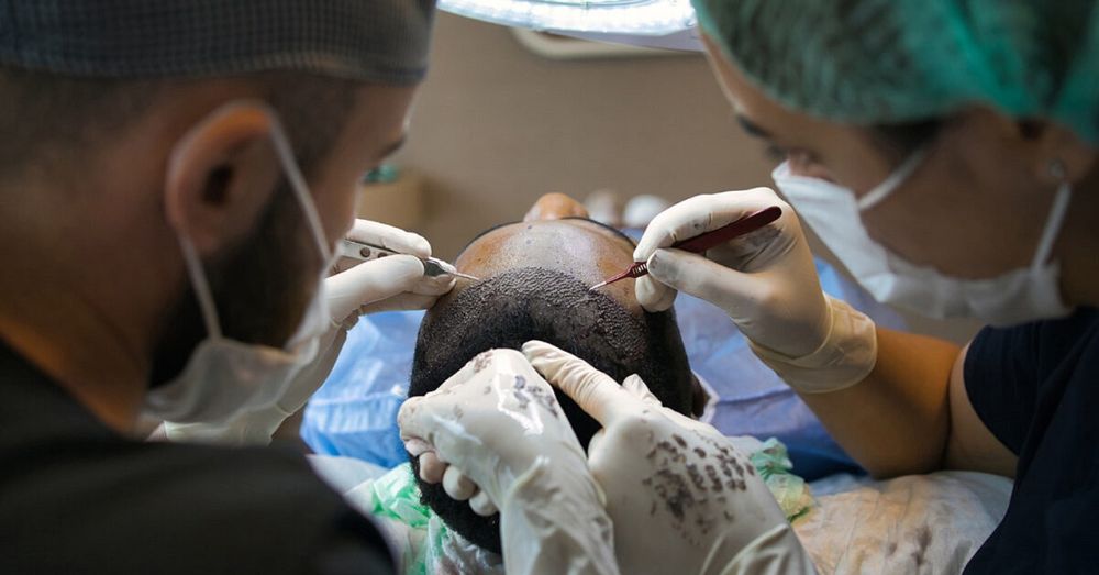 hårtransplantation i turkiet
